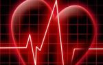 Дисметаболическая кардиомиопатия: что это такое, лечение
