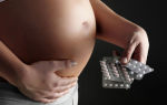 Синусовая аритмия при беременности чем грозит?