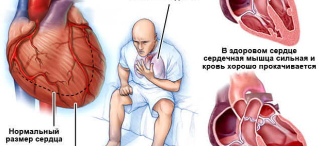 Почему высокое нижнее артериальное давление: причины, что это значит и что делать