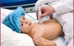 Дилатационная кардиомиопатия у детей: что это такое, причины, симптомы и внезапная смерть, отзывы и прогноз жизни