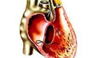 Расширение восходящего отдела аорты сердца
