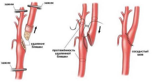 Операции, проводимые на сердце и кровеносных сосудах