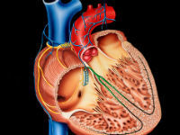 Как называется воспаление сердечной мышцы, симптомы и лечение