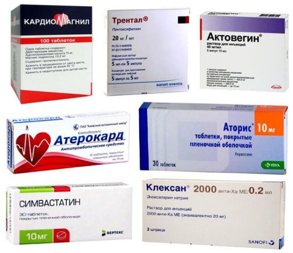 Лечение атеросклероза препаратами: обзор медикаментозных средств, статины как эффективное лекарство при заболевании