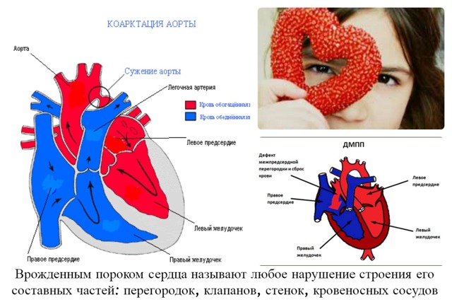 Заболевания сердечно сосудистой системы у детей: список, симптомы и лечение