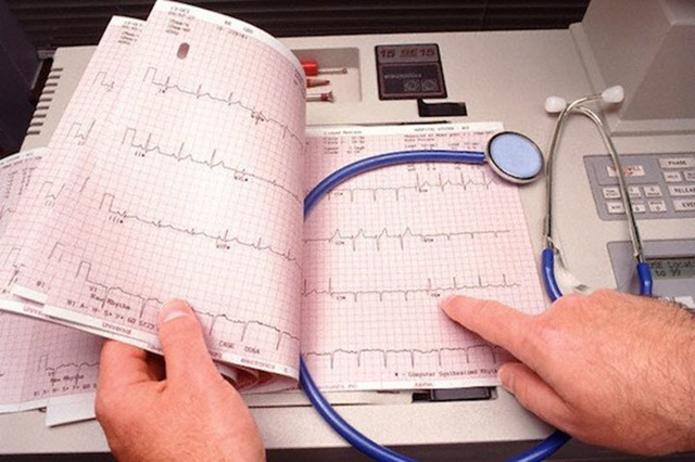 Сбой ритма сердца: причины, лечение, что делать, диагноз и краткая характеристика