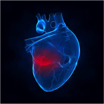 Инфаркт миокарда: причины развития, факторы риска, диагностика и лечение