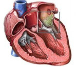 Первичный и возвратный ревмокардит сердца: что это такое, симптомы и лечение