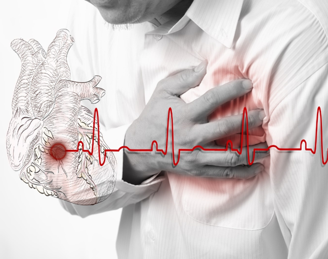 Рубец на сердце после инфаркта: что это такое, причины возникновения, симптомы и лечение, фото