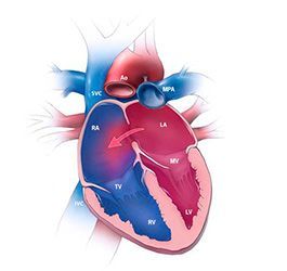 Порок сердца операция: сколько стоит