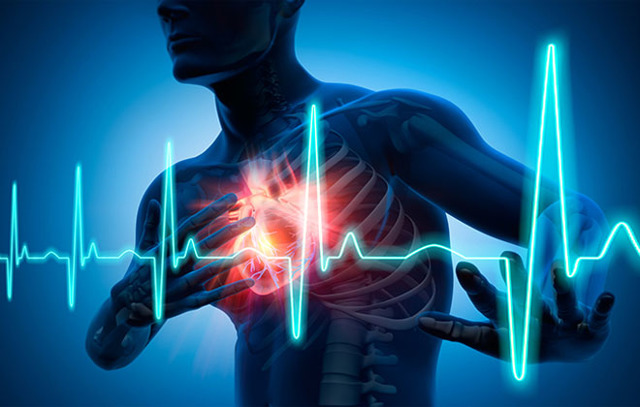 Абдоминальная форма инфаркта миокарда: симптомы