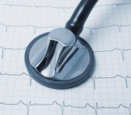 Нарушение ритма сердца: что это такое, классификация, причины, симптомы и лечение