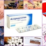 Лекарства для лечения атеросклероза нижних конечностей: мази и другие медикаментозные препараты при облетерическом поражении сосудов
