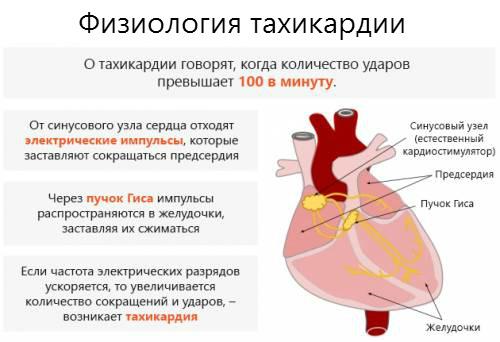 Тахикардия сердца: что это такое, признаки, симптомы и лечение
