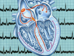 Аритмия сердца: причины, лечение народными средствами женщин и мужчин