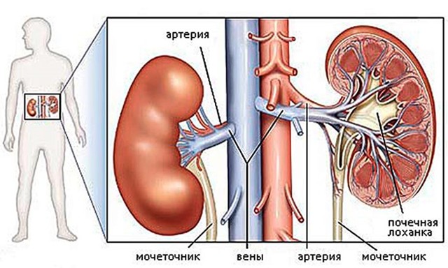 Пиелонефрит: гипертензия и артериальное давление