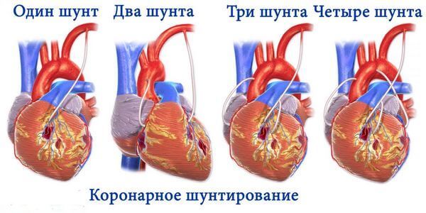 Операции, проводимые на сердце и кровеносных сосудах