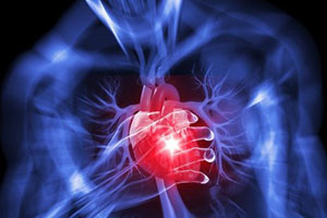 Причина смерти – ишемическая кардиомиопатия: что это такое?
