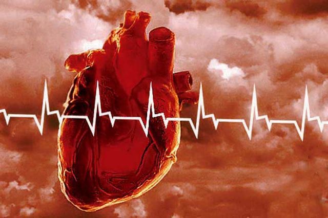 Атеросклеротический кардиосклероз: что это за диагноз, особенности лечения, причина смерти пациентов
