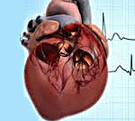 Легочное сердце: что это такое, симптомы и лечение, прогноз и рекомендации