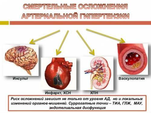 Осложнения артериальной гипертензии и гипертонии