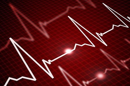 Медикаментозная и электрическая кардиоверсия при мерцательной аритмии и фибрилляции предсердий
