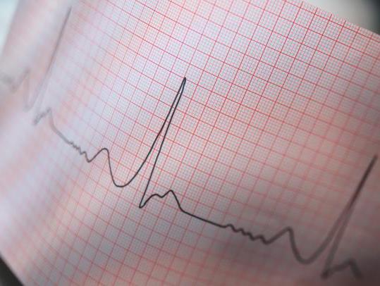 Первые признаки инфаркта у мужчин: как распознать симптомы прединфаркта, лечение