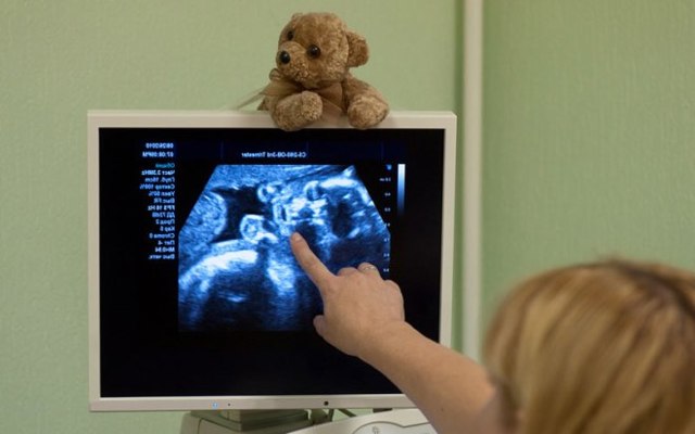 УЗИ сердца грудному ребенку: расшифровка результатов ЭХО КГ
