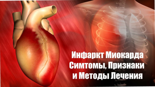 Мелкоочаговый инфаркт миокарда на экг